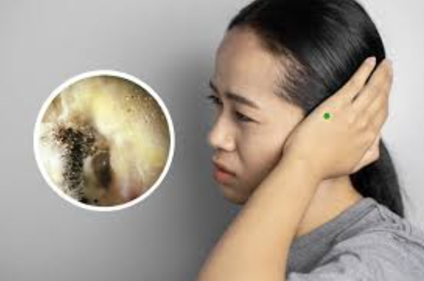 Understanding Ear Infections: Symptoms, Causes, and Treatment